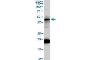 LEF1 monoclonal antibody (M01), clone 3H5. (LEF1 anticorps  (AA 1-399))