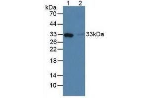 Western blot analysis of (1) Human Liver Tissue and (2) Human Lung Tissue. (FCN1 anticorps  (AA 45-249))