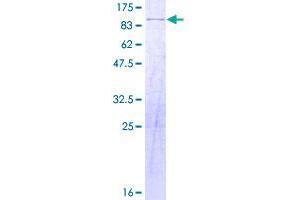Image no. 1 for Wolf-Hirschhorn Syndrome Candidate 2 (WHSC2) (AA 1-528) protein (GST tag) (ABIN1325325)