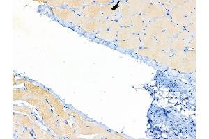 ABIN6258031 and ABIN6274975 at 1/100 staining Rat skin tissue by IHC-P. (CPT1B anticorps  (Internal Region))
