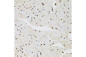 Immunohistochemistry of paraffin-embedded mouse heart using FOSL1 antibody (ABIN5973108) at dilution of 1/100 (40x lens). (FOSL1 anticorps)