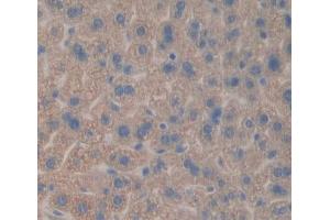 Used in DAB staining on fromalin fixed paraffin- embedded liver tissue (CES1 anticorps  (AA 31-286))