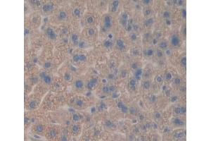 Used in DAB staining on fromalin fixed paraffin- embedded liver tissue