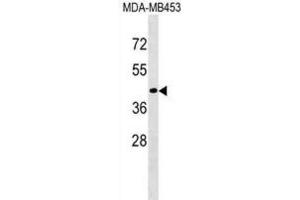 Western Blotting (WB) image for anti-CD200 Receptor 1-Like (CD200R1L) antibody (ABIN3000748) (CD200R1L anticorps)
