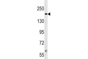 TSC2 antibody western blot analysis in Jurkat lysate