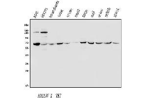 Western blot analysis of Transketolase/TKT using anti-Transketolase/TKT antibody (ABIN7598959). (TKT anticorps  (AA 1-116))