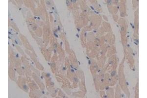 Detection of MAP6 in Mouse Heart Tissue using Polyclonal Antibody to Microtubule Associated Protein 6 (MAP6)