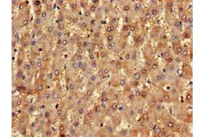 Immunohistochemistry of paraffin-embedded human liver tissue using ABIN7161655 at dilution of 1:100 (NLRX1 anticorps  (AA 45-205))