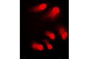 Immunofluorescent analysis of CBP staining in A431 cells.
