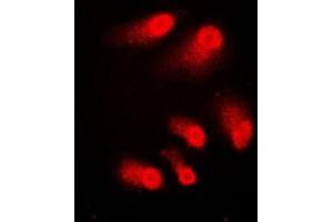 Immunofluorescent analysis of CBP staining in A431 cells. (CBP anticorps  (C-Term))