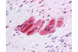 Immunohistochemistry (IHC) image for anti-Selenoprotein N, 1 (SEPN1) (C-Term) antibody (ABIN617009) (SEPN1 anticorps  (C-Term))