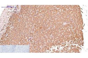 Immunohistochemistry of paraffin-embedded Human liver tissue using CK-17 Monoclonal Antibody at dilution of 1:200. (KRT17 anticorps)