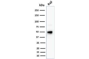 Western Blot Analysis of human Raji cell lysate using CD79a Mouse Monoclonal Antibody (JCB117 + HM47/A9). (CD79a anticorps  (AA 202-216))