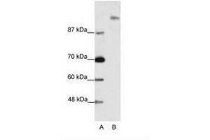Image no. 1 for anti-Suppressor of Ty 6 Homolog (SUPT6H) (N-Term) antibody (ABIN202988) (Spt6 anticorps  (N-Term))