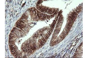 Immunohistochemistry (IHC) image for anti-ALX Homeobox 4 (ALX4) antibody (ABIN1496621)