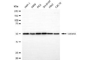 anti-Tubulin beta 4a (TUBB4A) antibody