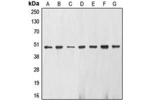 Western blot analysis of Gamma-enolase expression in U937 (A), K562 (B), Jurkat (C), NIH3T3 (D), KNRK (E), HepG2 (F), HeLa (G) whole cell lysates. (ENO2/NSE anticorps  (C-Term))