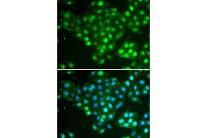 Immunofluorescence analysis of HeLa cell using ABCA3 antibody.