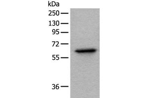 Western blot analysis of Hela cell lysate using BAIAP2L1 Polyclonal Antibody at dilution of 1:1000 (BAIAP2L1 anticorps)