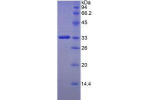 SDS-PAGE analysis of Human FKBP10 Protein. (FKBP10 Protéine)