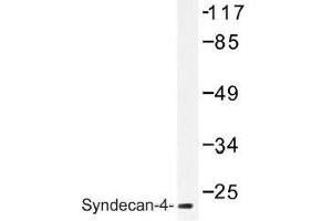 Image no. 1 for anti-Syndecan 4 (SDC4) antibody (ABIN317791) (SDC4 anticorps)