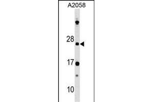 anti-DR1-Associated Protein 1 (Negative Cofactor 2 Alpha) (DRAP1) (AA 1-29), (N-Term) antibody