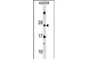 DR Antibody (N-term) 8211a western blot analysis in  cell line lysates (35 μg/lane). (DRAP1 anticorps  (N-Term))
