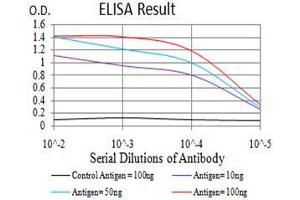 Black line: Control Antigen (100 ng),Purple line: Antigen (10 ng), Blue line: Antigen (50 ng), Red line:Antigen (100 ng)