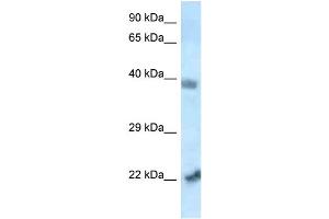 WB Suggested Anti-Vps72 Antibody   Titration: 1. (VPS72 anticorps  (N-Term))