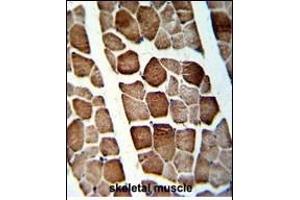 Formalin-fixed and paraffin-embedded human skeletal muscle with ATP5O Antibody (N-term), which was peroxidase-conjugated to the secondary antibody, followed by DAB staining.