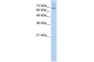 TSHR antibody used at 1 ug/ml to detect target protein. (TSH receptor anticorps  (N-Term))