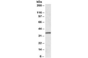 Western blot testing of human colon lysate with HOXA4 antibody at 0. (HOXA4 anticorps)