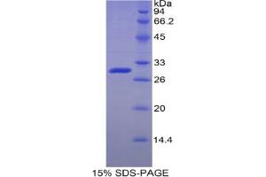 SDS-PAGE analysis of Human Adenosine Kinase Protein.