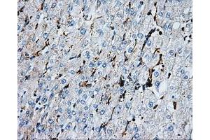 Immunohistochemical staining of paraffin-embedded liver tissue using anti-PSMC3mouse monoclonal antibody. (PSMC3 anticorps)