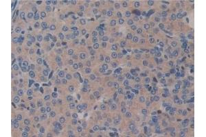 Detection of GAB3 in Mouse Ovary Tissue using Polyclonal Antibody to GRB2 Associated Binding Protein 3 (GAB3) (GAB3 anticorps  (AA 142-375))