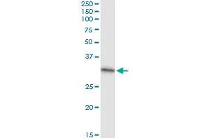 Immunoprecipitation of CACYBP transfected lysate using anti-CACYBP MaxPab rabbit polyclonal antibody and Protein A Magnetic Bead , and immunoblotted with CACYBP purified MaxPab mouse polyclonal antibody (B01P) .