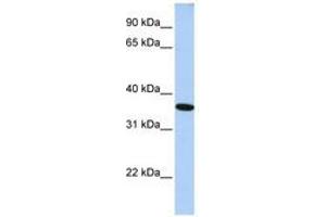 Image no. 1 for anti-General Transcription Factor IIA, 1, 19/37kDa (GTF2A1) (N-Term) antibody (ABIN6741429)