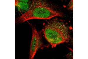 Immunofluorescent staining of human cell line U-251 MG shows positivity in nucleoli & nucleus but not nucleoli.