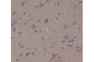 IHC-P analysis of Human Tissue, with DAB staining. (BIRC6 anticorps  (AA 4576-4857))