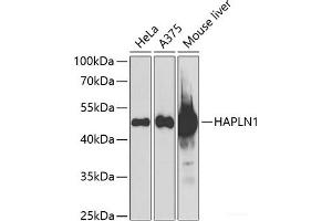 Western blot analysis of extracts of various cell lines using HAPLN1 Polyclonal Antibody at dilution of 1:1000. (HAPLN1 anticorps)