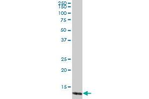 TCL1A MaxPab polyclonal antibody.