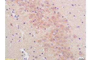Formalin-fixed and paraffin embedded rat brain labeled with Anti-Phospho-Mcl1 (Ser159/Thr163) Polyclonal Antibody, Unconjugated (ABIN743738) at 1:200, followed by conjugation to the secondary antibody and DAB staining (MCL-1 anticorps  (pSer159, pThr163))