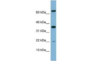 WB Suggested Anti-RWDD1  Antibody Titration: 0.