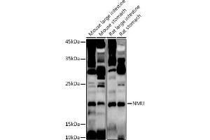 Western blot analysis of extracts of various cell lines, using NMU antibody (ABIN6128376, ABIN6144691, ABIN6144692 and ABIN6222862) at 1:1000 dilution. (Neuromedin U anticorps  (AA 35-174))