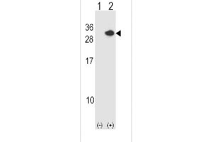 Western blot analysis of RCAN1 (arrow) using rabbit polyclonal RCAN1 Antibody (N-term) (ABIN1539360 and ABIN2848483). (RCAN1 anticorps  (N-Term))