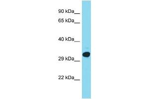 Host: Rabbit Target Name: C15orf23 Sample Type: HepG2 Whole Cell lysates Antibody Dilution: 1.
