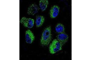 Immunofluorescence (IF) image for anti-Interleukin 13 (IL13) antibody (ABIN2997503)