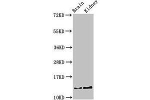 Western Blot Positive WB detected in: Mouse brain tissue, Mouse kidney tissue All lanes: PVALB antibody at 3 μg/mL Secondary Goat polyclonal to rabbit IgG at 1/50000 dilution Predicted band size: 13 kDa Observed band size: 13 kDa
