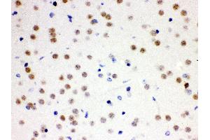 Anti- Cdc25B Picoband antibody, IHC(P) IHC(P): Mouse Brain Tissue (CDC25B anticorps  (AA 119-248))