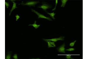 Immunofluorescence of monoclonal antibody to ARMET on HeLa cell. (MANF anticorps  (AA 116-185))